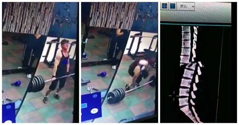 Китайский тяжелоатлет сломал позвоночник при попытке поднять штангу со слишком большим весом