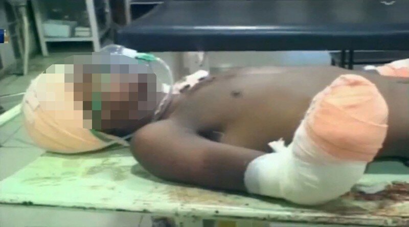 Мужчина отрезал парню руки после того, как узнал, что тот сделал с его 7-месячной дочкой
