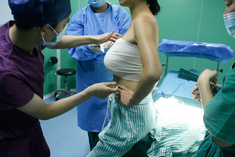 «Пластика Золушки»: японцы практикуют увеличение груди на сутки