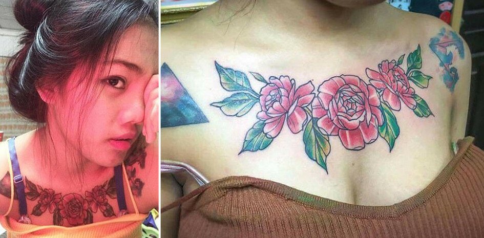 Самостоятельная попытка удалить татуировку изуродовала студентку