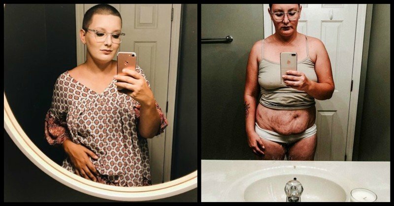Женщина показала, как выглядит ее тело после 6 выкидышей и 4 родов