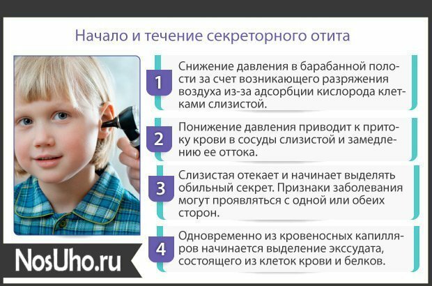 Как вылечить шум в ушах после отита