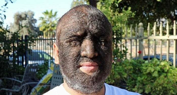 Это самый волосатый мужчина в мире: 98% его тела покрыты густыми темными волосами