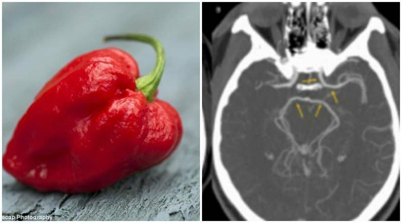 Американец попал в больницу после того, как съел самый острый перец в мире