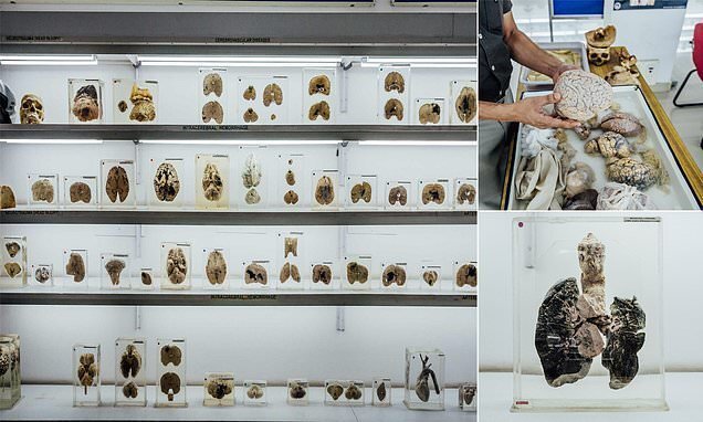 В Индии открылся Музей мозга, в котором экспонаты можно потрогать