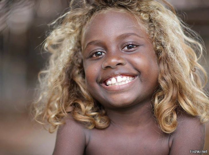 Жители Меланезии с Соломоновых островов — сочетание темной кожи и очень светл...
