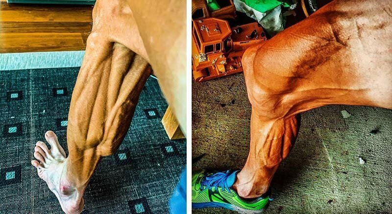 Велосипедист, борющийся с булимией, шокировал фотографией своих ног