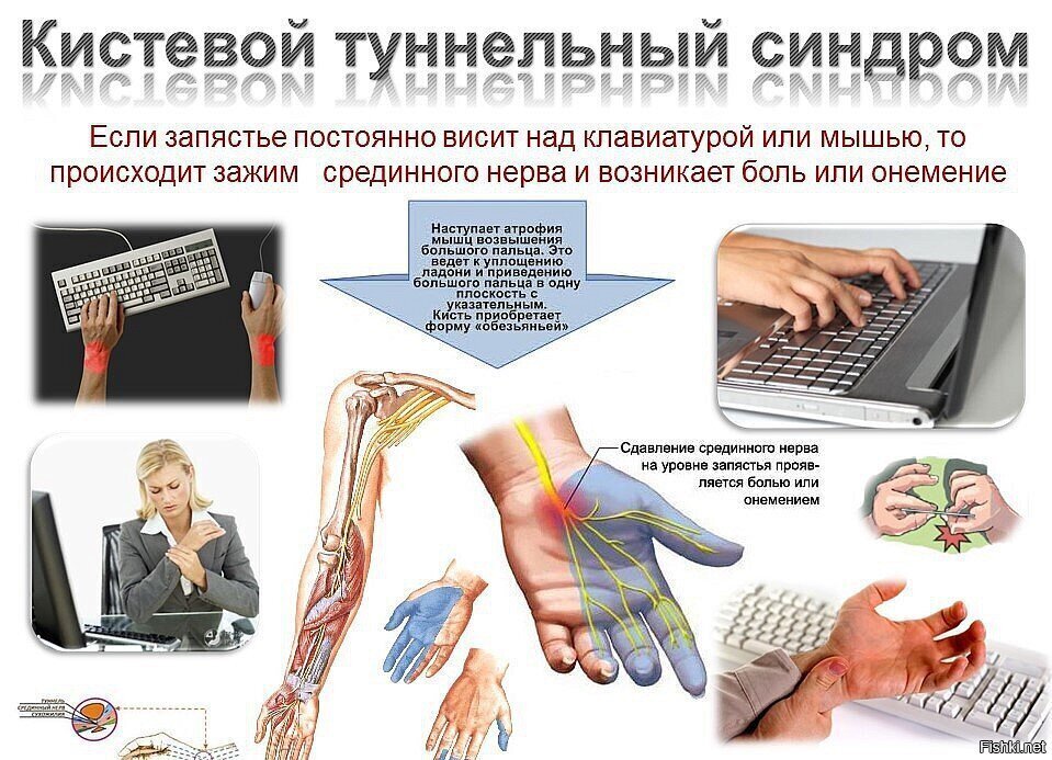 А помните,в конце 90-х были страшилки про "туннельный синдром"