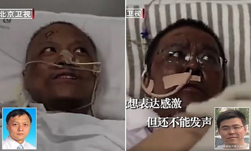 После лечения от коронавируса китайские врачи стали темнокожими