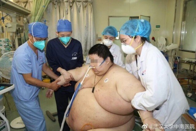 Молодой китаец за время 5-месячного карантина набрал почти центнер лишнего веса 