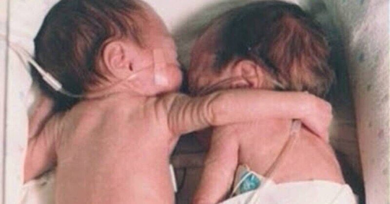 Медсестра кладёт здорового ребёнка рядом с умирающим близнецом и тут происходит настоящее чудо!