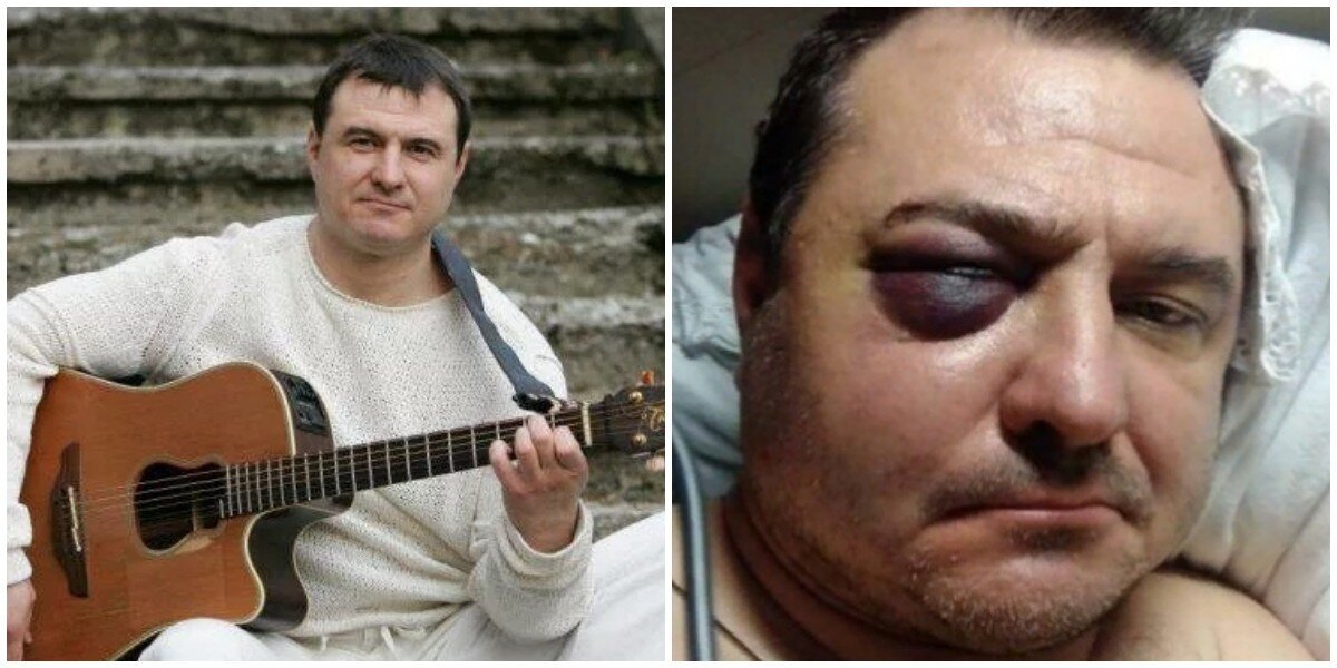 Бывшего солиста "Лесоповал" избили в Сочи за громкую пьянку