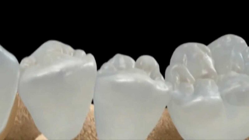 Исследователи нашли средство, которое позволяет вырастить новые зубы