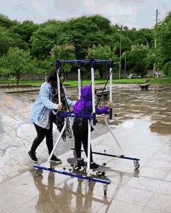 у шкета дцп