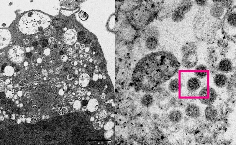 Ученые опубликовали фотографии вируса «Омикрон»