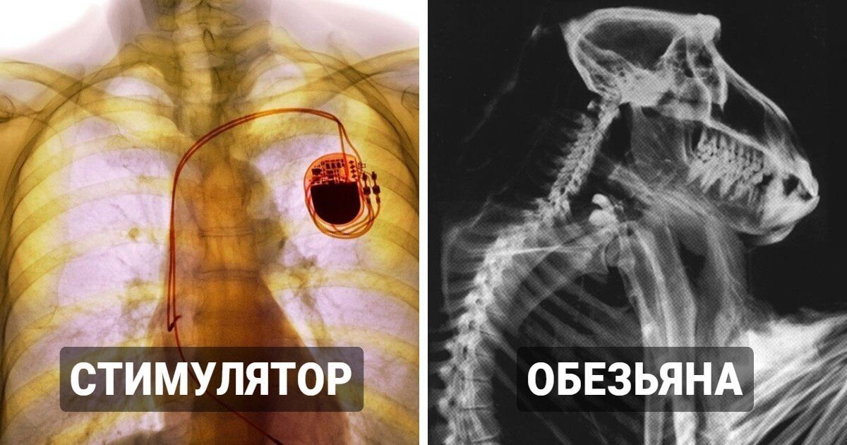 18 занятных рентгеновских снимков