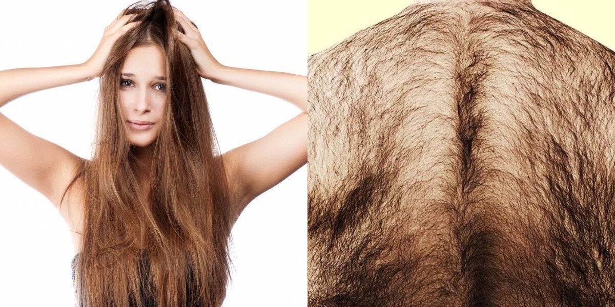 Почему волоски на теле не могут вырасти длиннее, нежели на голове?