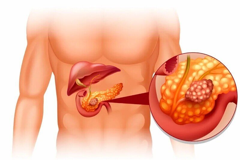 Где у человека находится поджелудочная железа