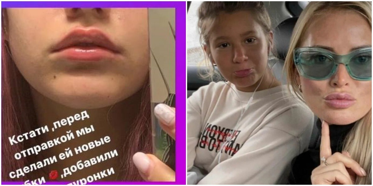 Дана Борисова похвасталась в социальных сетях тем, что увеличила 15-летней дочери губы
