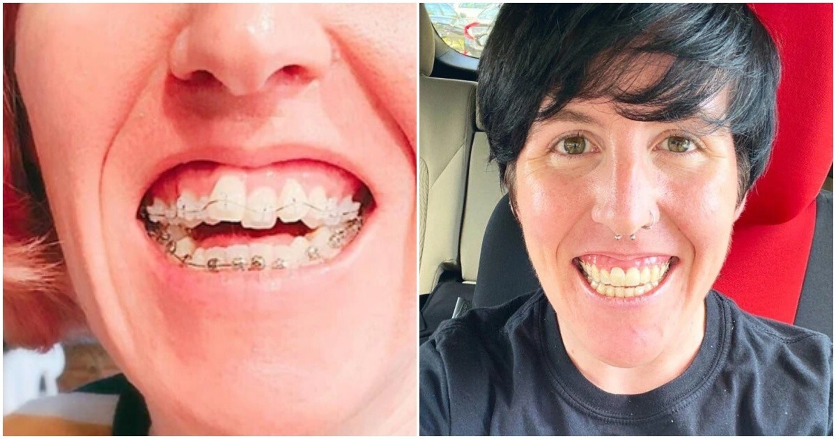 Люди, которые изменили жизнь, когда занялись зубами