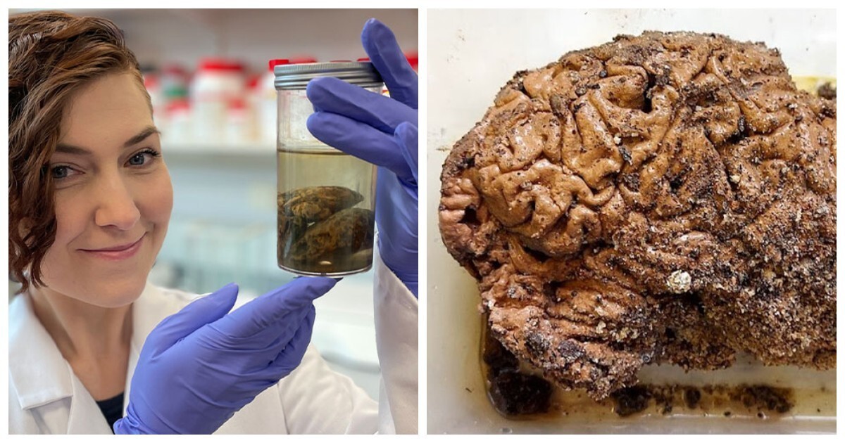 Учёные хотят выяснить, почему археологи иногда находят в древних черепах сохранившийся мозг