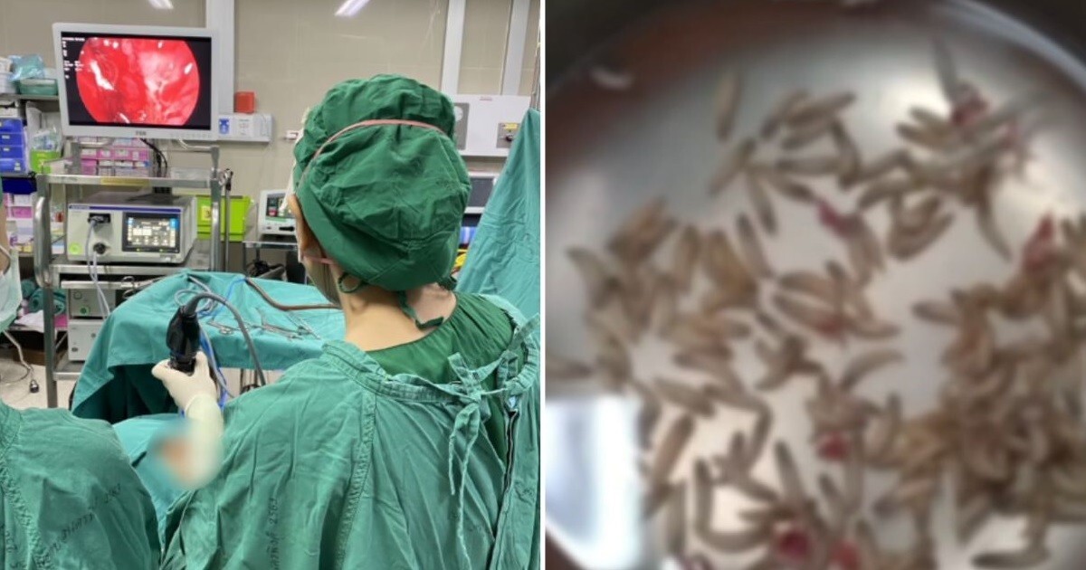 Жительница Таиланда обнаружила в носу сотни личинок