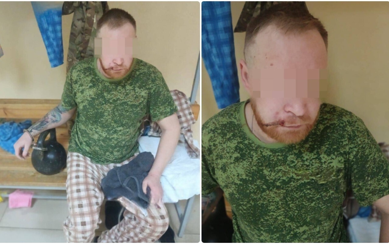 Контрактника с Кубани пытают в медроте: сломаны пальцы, к рукам приковали гирю