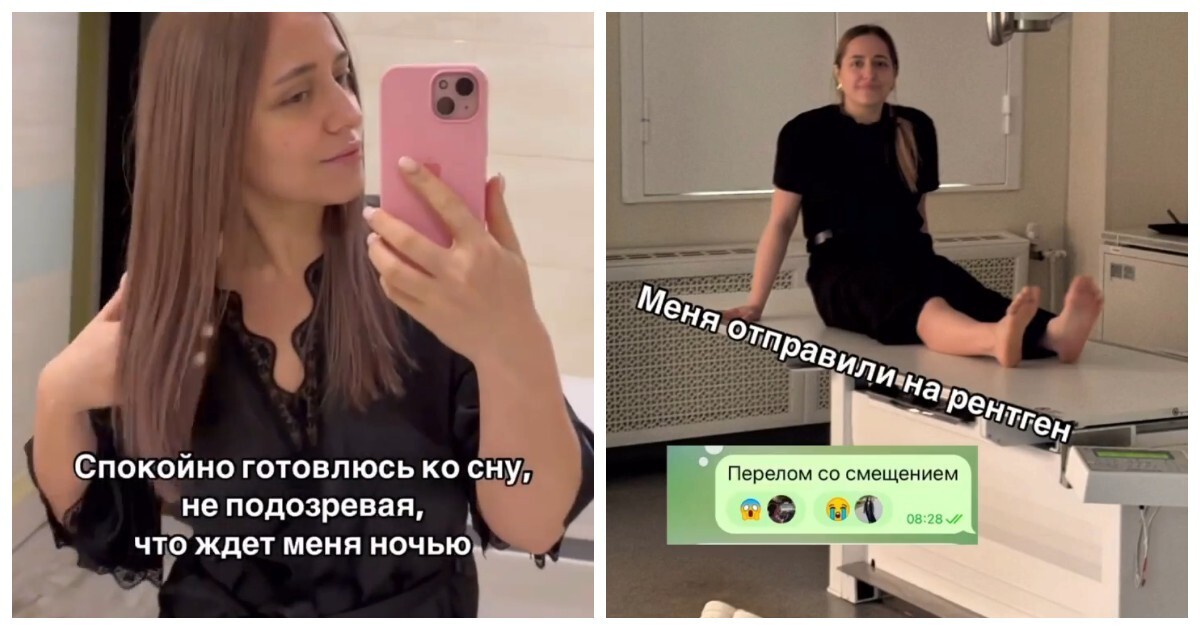 Плюс фобия: девушка ударилась мизинцем об угол кровати и ей пришлось делать операцию