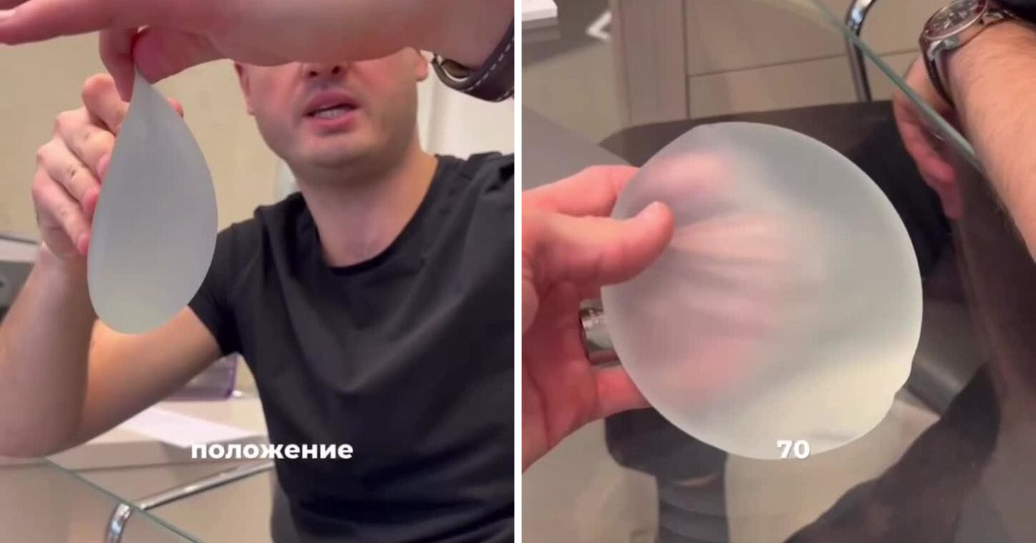 Самые дорогие импланты