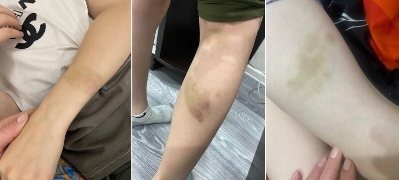 В Чечне преподаватель школы хафизов избивал детей палкой