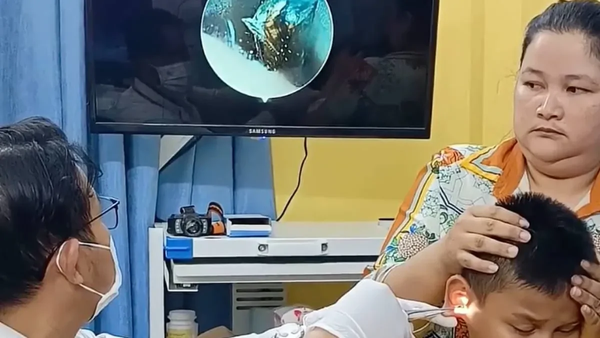 В Камбодже у подростка в ухе обнаружили живого таракана