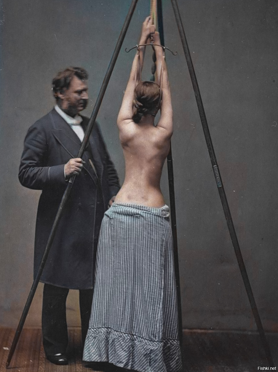 Профессор Льюис Сайр лечит сколиоз, проверяя искривление позвоночника на свое...