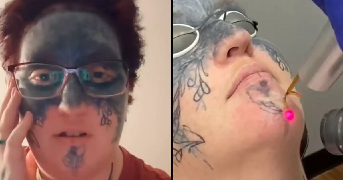 Женщина сводит с лица насильно нанесённые татуировки