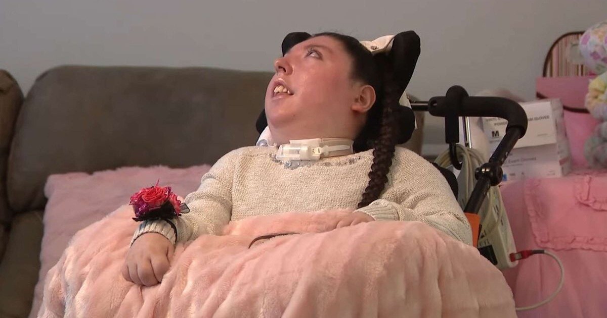 Родившейся без мозга девушке исполнилось 20 лет