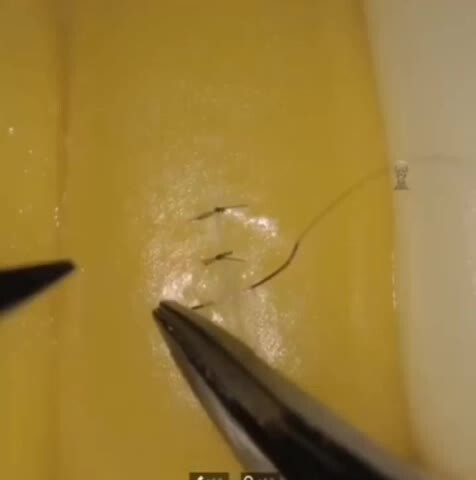 Робот-ассистент хирурга от Sony проводит на кукурузе операцию, имитирующую за...