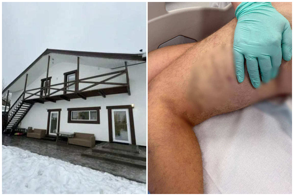 В Подмосковье задержали администратора рехаба с комнатой пыток для подростков