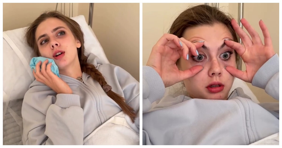 Девушка удивила всех своим поведением после наркоза