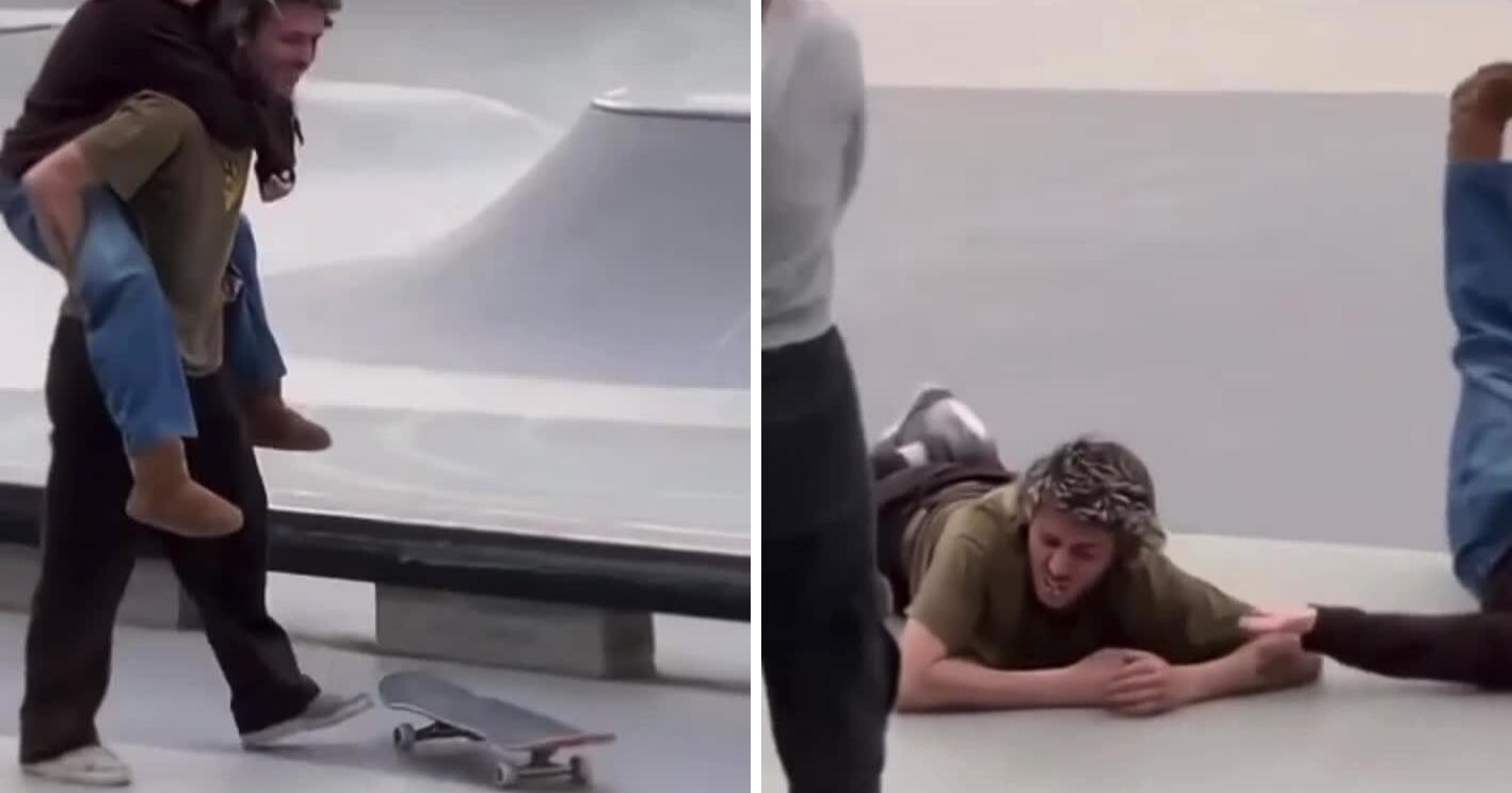 В США парень остался без зубов, пытаясь эффектно прокатиться на скейте с девушкой