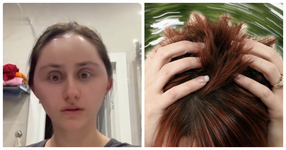 Москвичке раздуло голову после покраски волос
