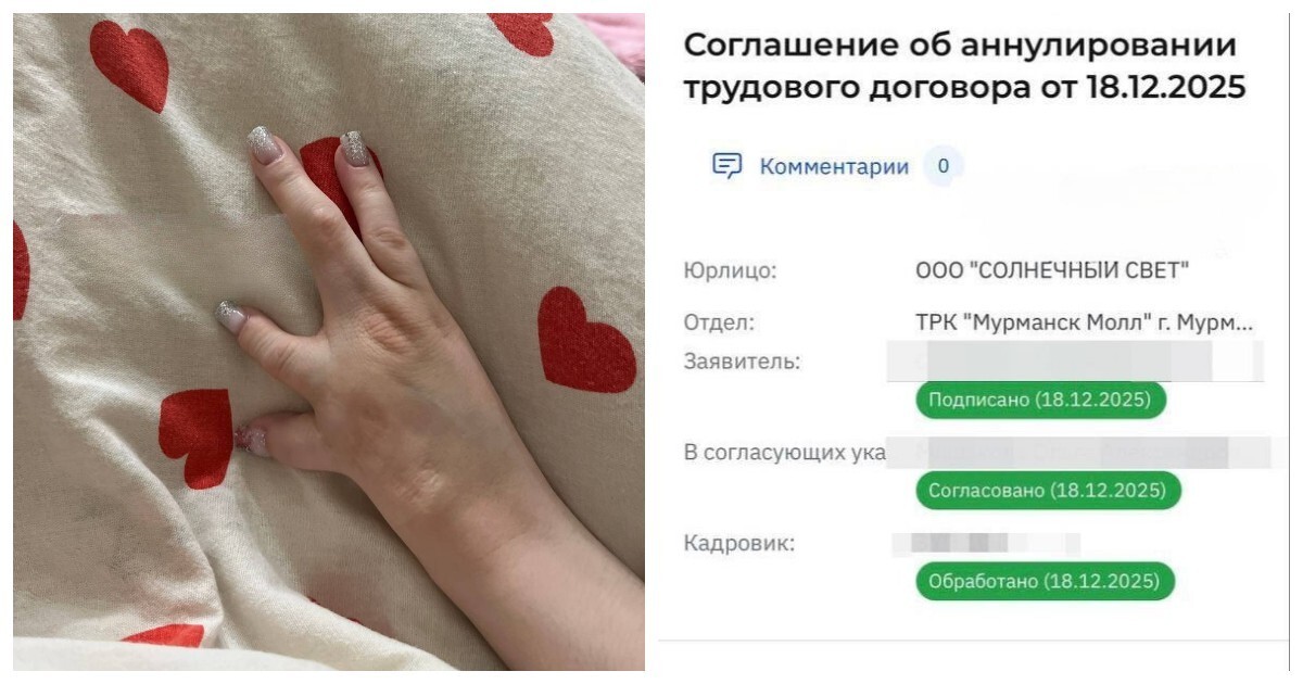 Девушку с инвалидностью уволили за «непрезентабельную» руку