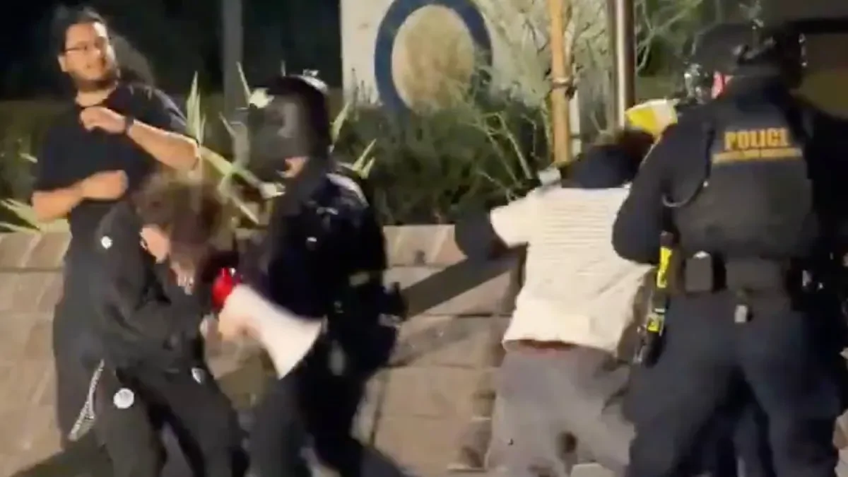 21‑летний участник протеста ослеп на один глаз после выстрела в лицо