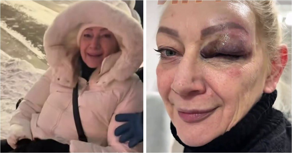 Спуск с горки на ватрушке закончился травмпунктом