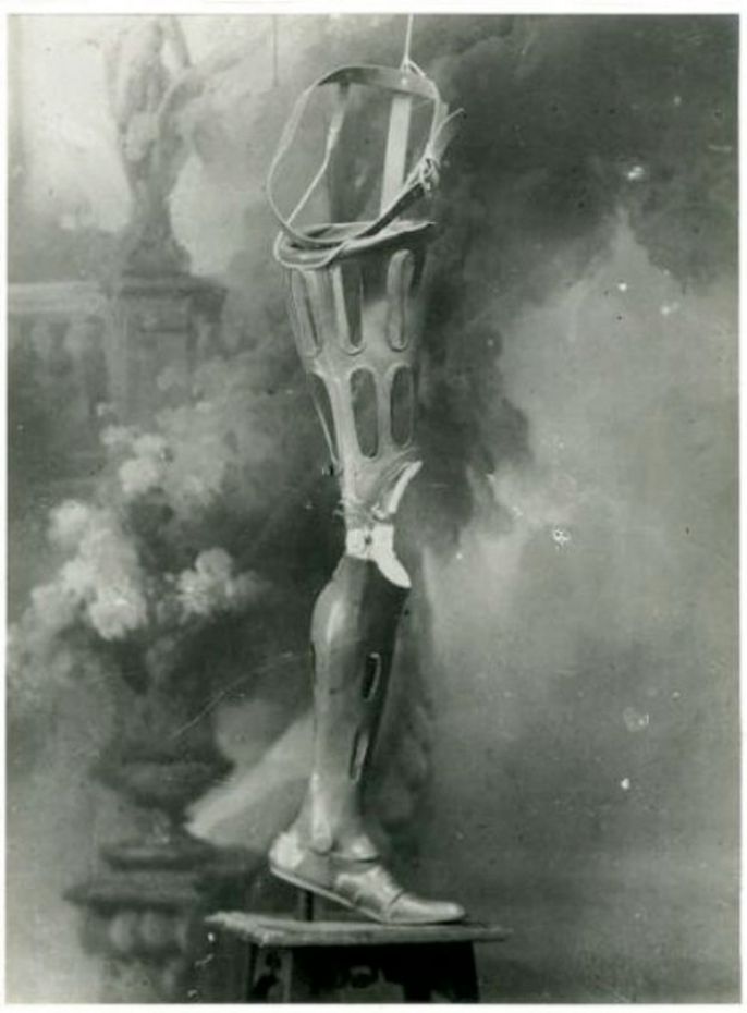 2. Prosthetic leg, 1918