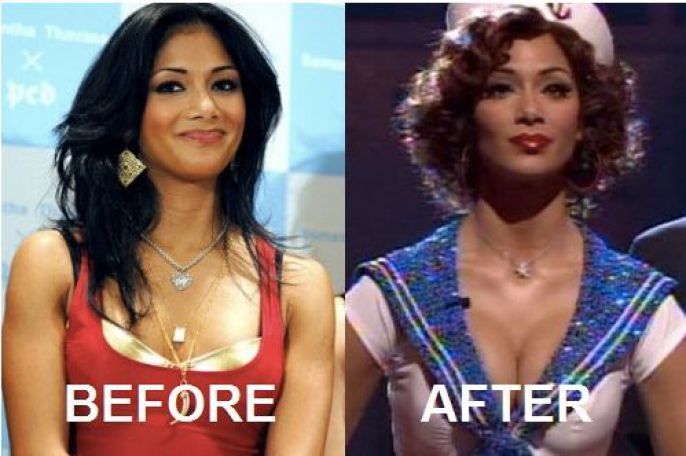 Before and After Plastic Surgery 