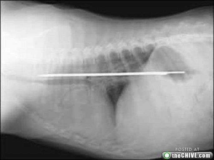 Disgusting X-Ray Metal Piece In Body 