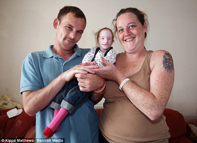 The Parents of the world smallest girl 