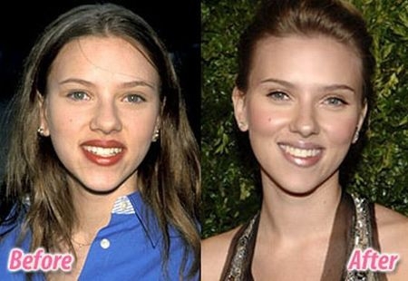 Can you believe they had plastic surgery?