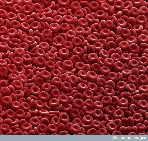 Up so close: Can you tell what these are?