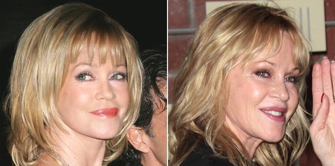 Melanie Griffith is Mocked for her Appearence