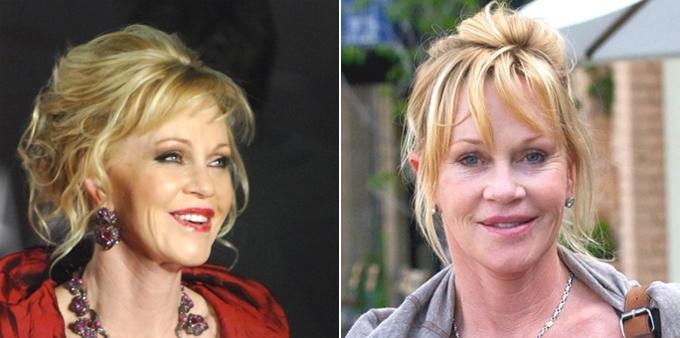 Melanie Griffith is Mocked for her Appearence